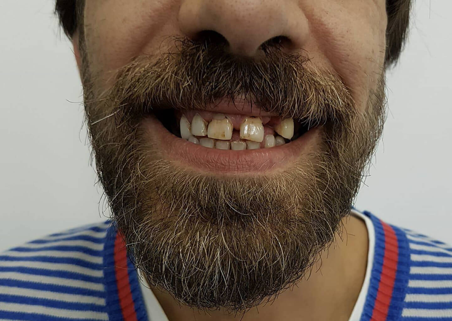 filipe-ferreira-implantologia-2-4