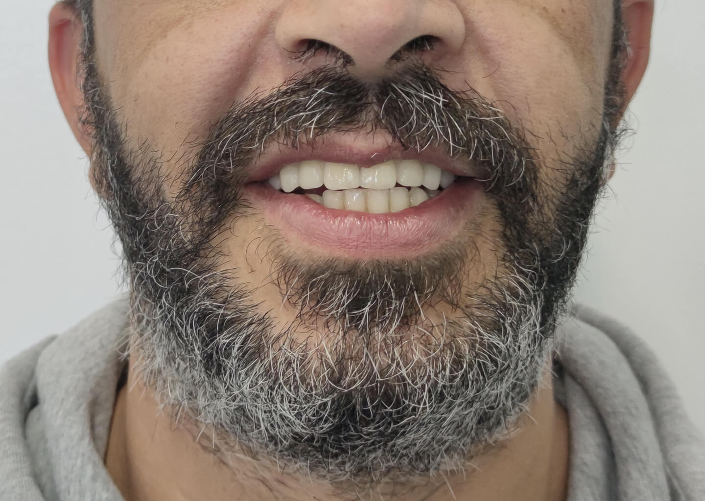 filipe-ferreira-implantologia-3