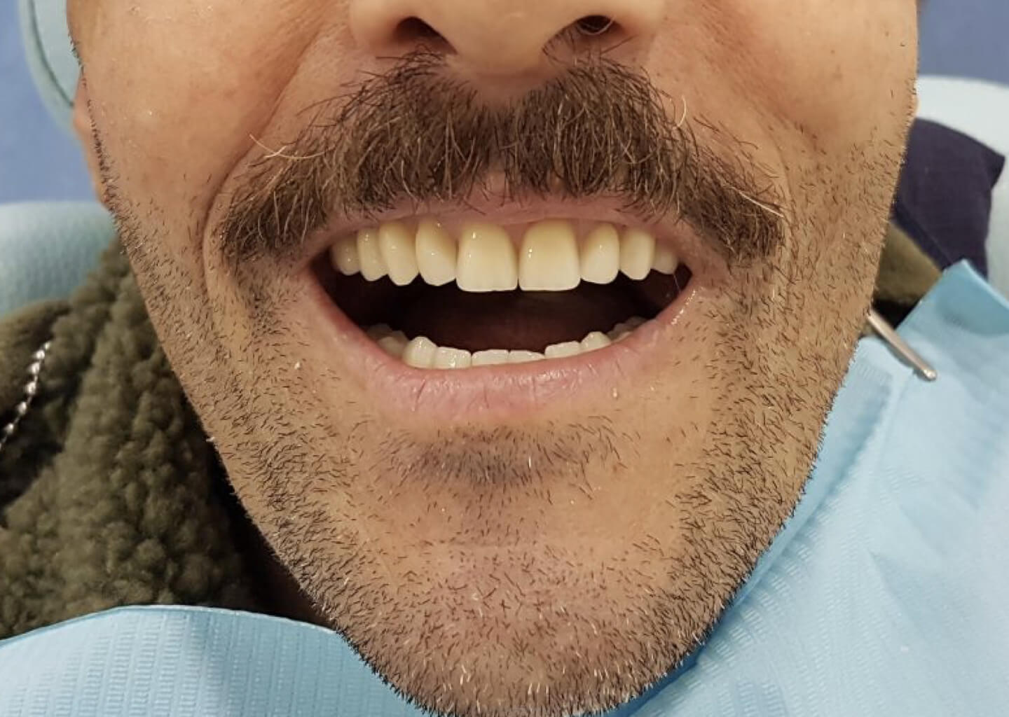 filipe-ferreira-implantologia-6-5