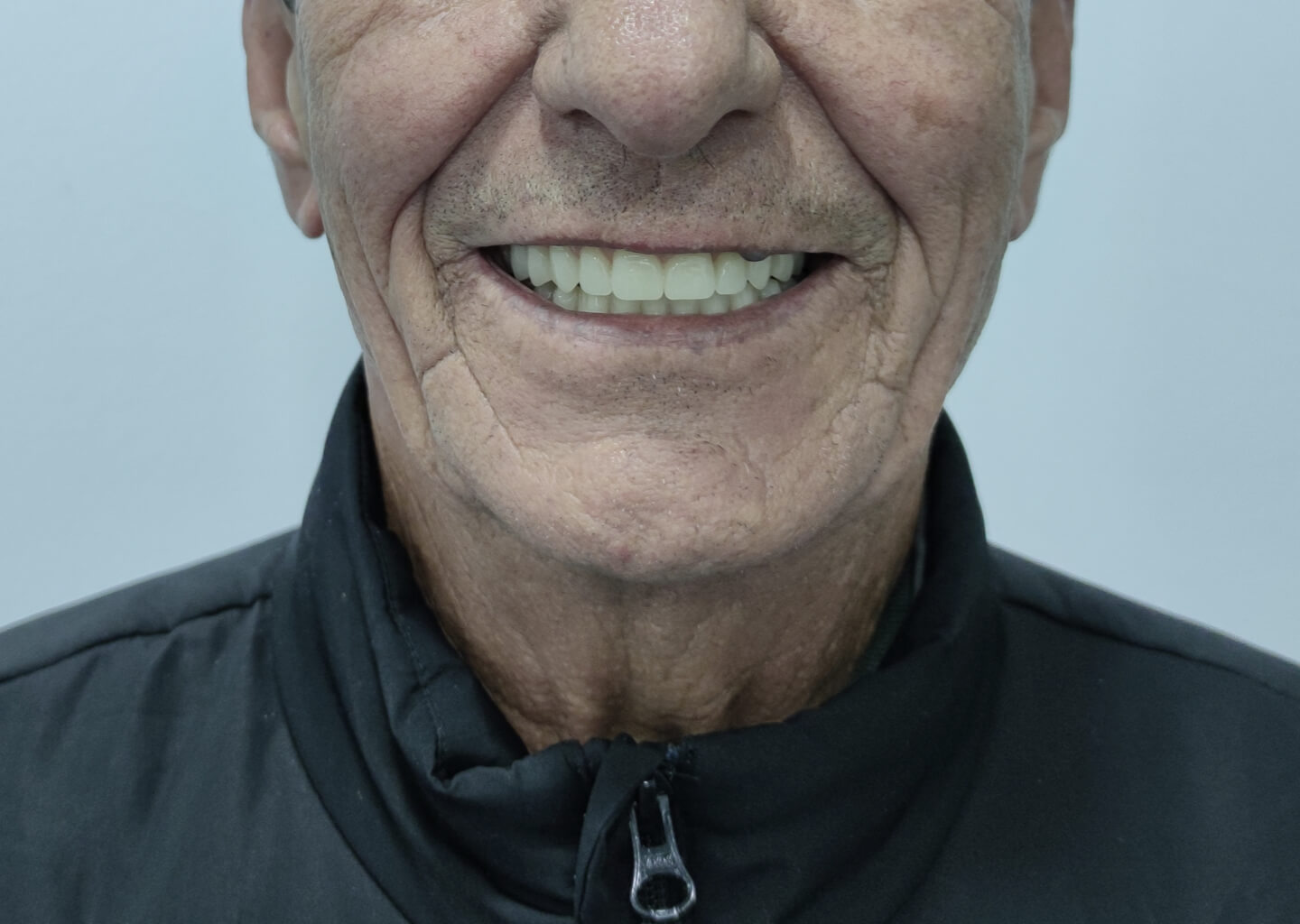 filipe-ferreira-protese-removivel-12